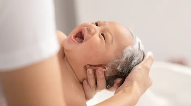 Choosing Gentle Shampoo for Cradle Cap
